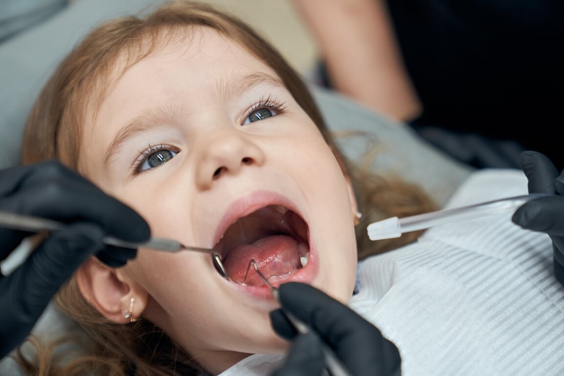 Фторирование зубов у детей
