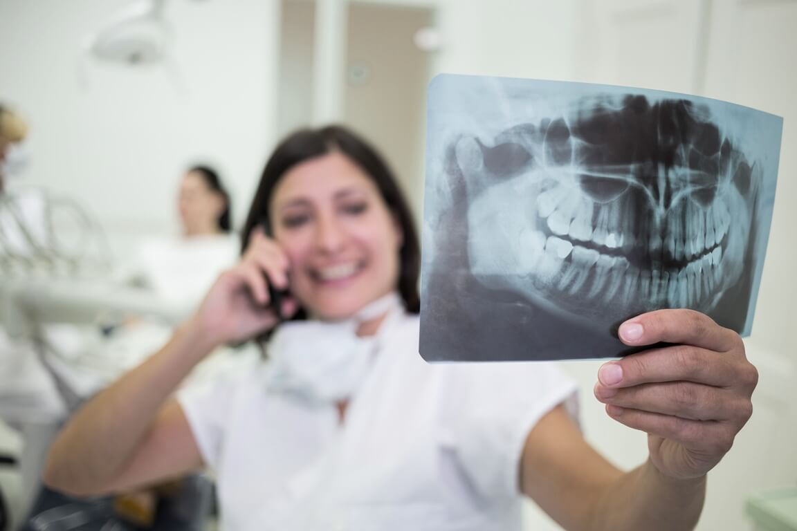 Рентген зуба (радиовизиография)